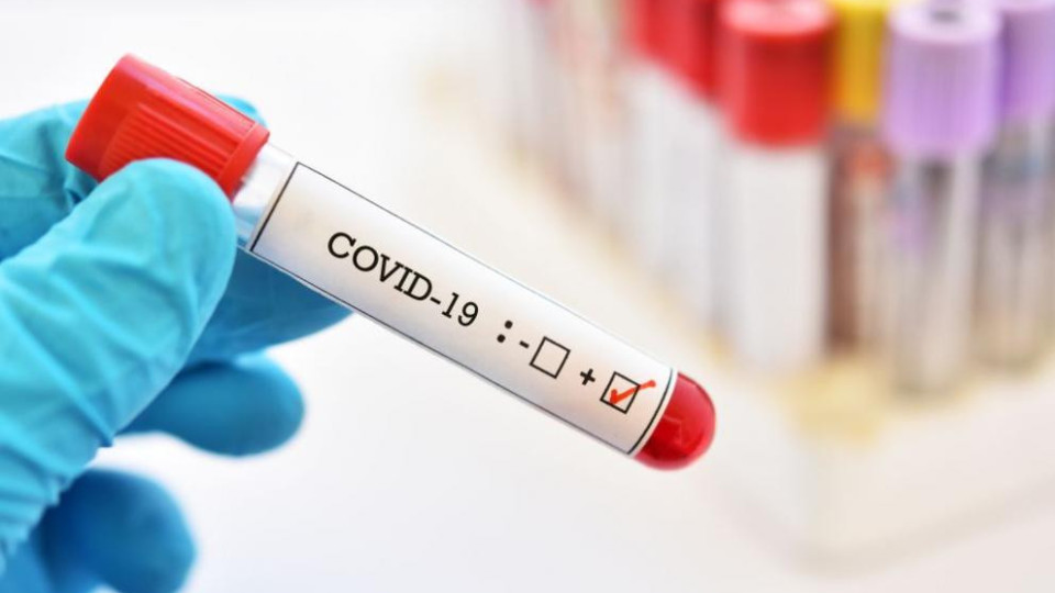 Хора от коя кръвна група нямат усложнения от Ковид-19!