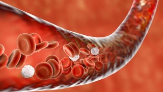 Защо и как да почистваме кръвоносните съдове?(Рецептата)