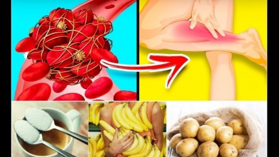 Кои храни причиняват образуването на кръвни тромби?
