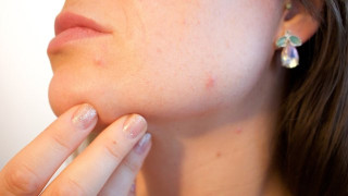 Имате глутенова непоносимост? По тези признаци ще я познаете
