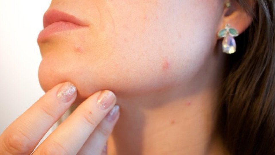 Имате глутенова непоносимост? По тези признаци ще я познаете