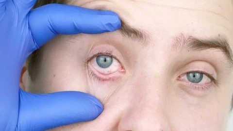 С това чудо: Сваляте по два диоптъра на месец!