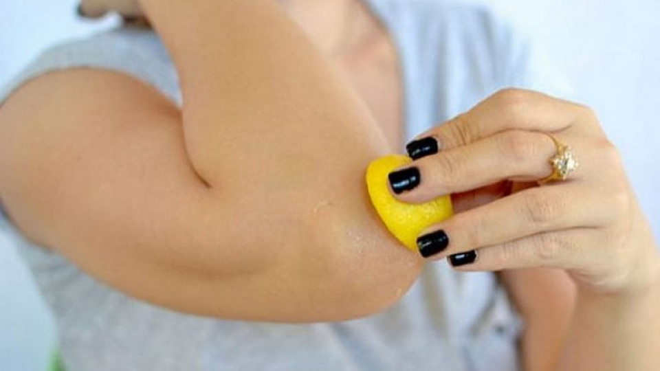 С тези домашни рецепти: Избелваме кожата на лактите и коленете