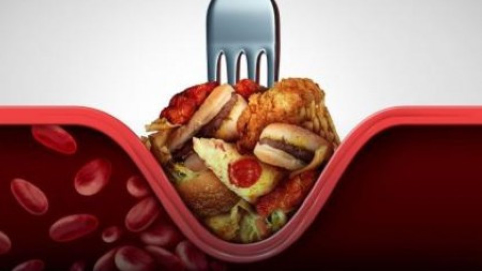 Възможно ли е да намалим „лошия холестерол“ без хапчета?