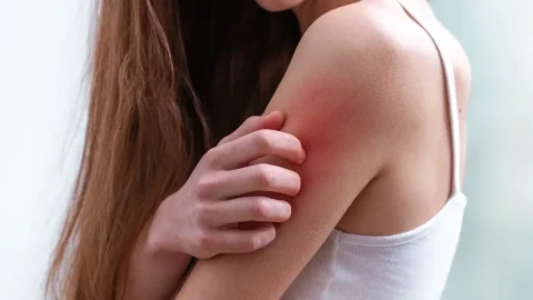 Сърбежът-за какви здравословни проблеми сигнализира