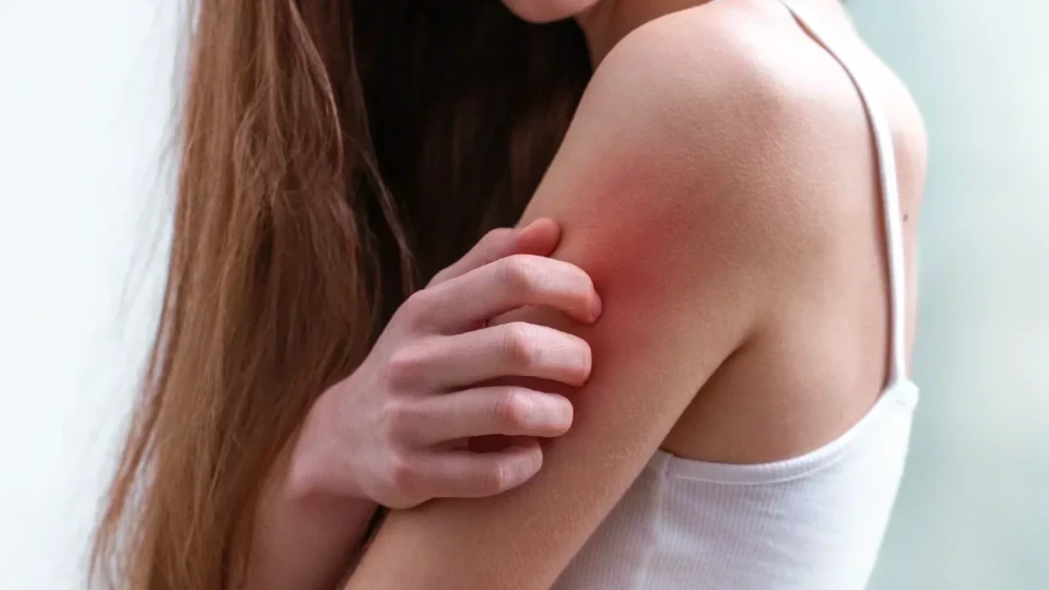 Сърбежът-за какви здравословни проблеми сигнализира