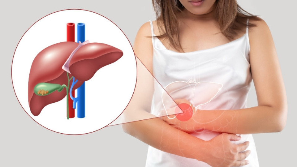 С тези промени: Може да преборите риска от образуване на камъни в жлъчката