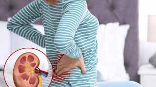 С тези домашни средства: Лекувате болезнените камъни в бъбреците