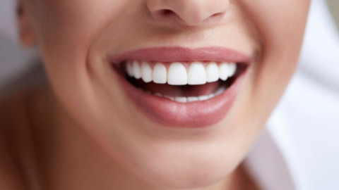 Спазвайте тези препоръки! И ще ходите по-рядко при зъболекар