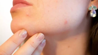 Какво разкриват: Пъпките, които се появяват по различни части на тялото ни?