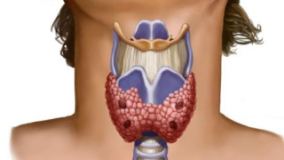 Тези симптоми показват: Имаме ли проблеми с щитовидната жлеза