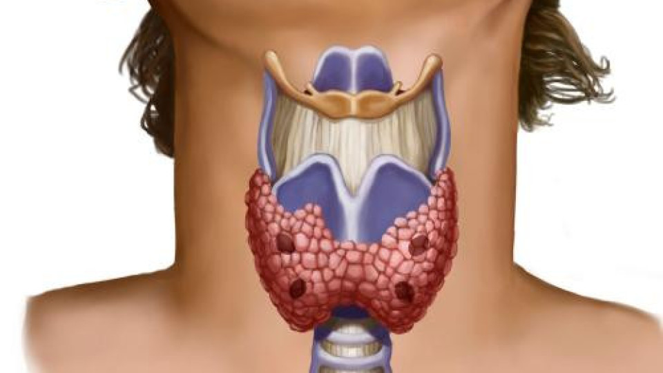 Тези симптоми показват: Имаме ли проблеми с щитовидната жлеза